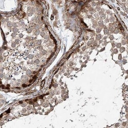 SF4 Antibody - BSA Free, Novus Biologicals 100 &mu;g | Buy Online | Novus Biologicals | Fisher Scientific