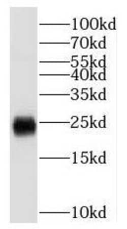 Scn2b Antibody - BSA Free, Novus Biologicals 100 &mu;g | Buy Online | Novus Biologicals | Fisher Scientific