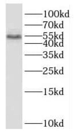 SCHIP1 Antibody - BSA Free, Novus Biologicals 100 &mu;g | Buy Online | Novus Biologicals | Fisher Scientific