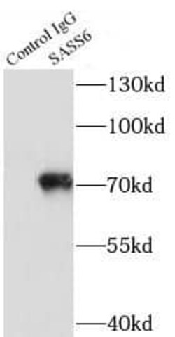 SASS6 Antibody - BSA Free, Novus Biologicals 100 &mu;g | Buy Online | Novus Biologicals | Fisher Scientific