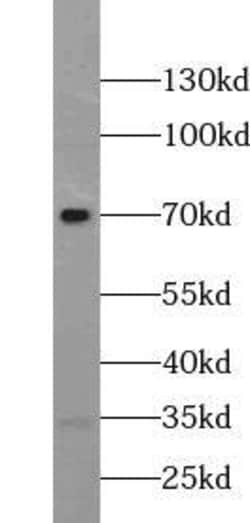 ZNF251 Antibody - BSA Free, Novus Biologicals 100 &mu;g | Buy Online | Novus Biologicals | Fisher Scientific