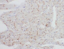 ZNF146 Antibody - BSA Free, Novus Biologicals 100 &mu;g | Buy Online | Novus Biologicals | Fisher Scientific
