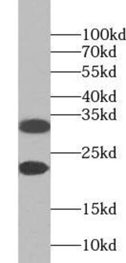 ZNF146 Antibody - BSA Free, Novus Biologicals 100 &mu;g | Buy Online | Novus Biologicals | Fisher Scientific