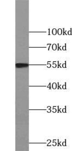 NIPA Antibody - BSA Free, Novus Biologicals 100 &mu;g | Buy Online | Novus Biologicals | Fisher Scientific