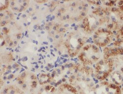 ZC3HAV1L Antibody - BSA Free, Novus Biologicals 100 &mu;g | Buy Online | Novus Biologicals | Fisher Scientific