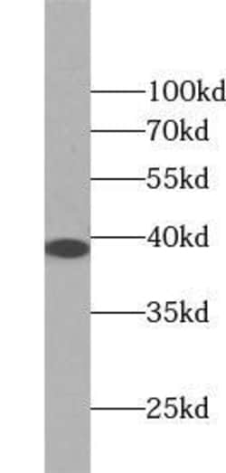 ZC3HAV1L Antibody - BSA Free, Novus Biologicals 100 &mu;g | Buy Online | Novus Biologicals | Fisher Scientific