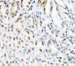 YTHDF3 Antibody - BSA Free, Novus Biologicals 100 &mu;g | Buy Online | Novus Biologicals | Fisher Scientific