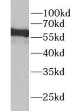 YTHDF3 Antibody - BSA Free, Novus Biologicals 100 &mu;g | Buy Online | Novus Biologicals | Fisher Scientific