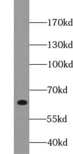 YTHDF2 Antibody - BSA Free, Novus Biologicals 100 &mu;g | Buy Online | Novus Biologicals | Fisher Scientific