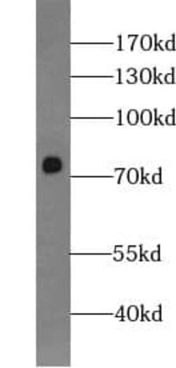 WDR46 Antibody - BSA Free, Novus Biologicals 100 &mu;g | Buy Online | Novus Biologicals | Fisher Scientific