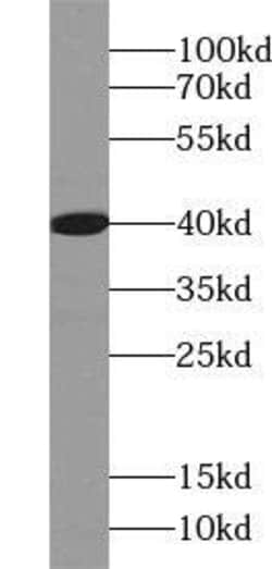 WDR45 Antibody - BSA Free, Novus Biologicals 100 &mu;g | Buy Online | Novus Biologicals | Fisher Scientific