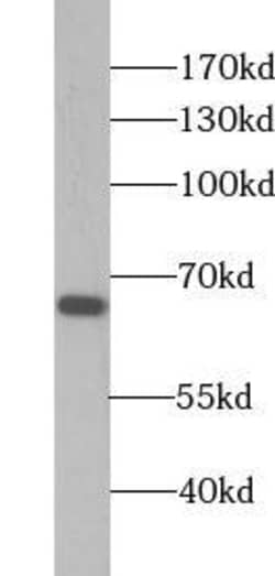 WDR16 Antibody - BSA Free, Novus Biologicals 100 &mu;g | Buy Online | Novus Biologicals | Fisher Scientific