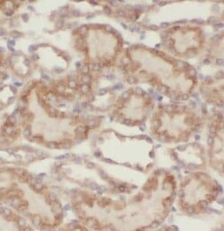 VPS33B Antibody - BSA Free, Novus Biologicals 100 &mu;g | Buy Online | Novus Biologicals | Fisher Scientific