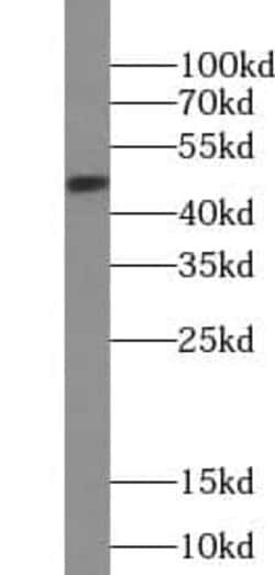 VPREB3 Antibody - BSA Free, Novus Biologicals 100 &mu;g | Buy Online | Novus Biologicals | Fisher Scientific