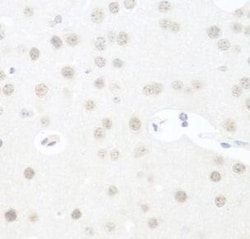 UTP14A Antibody - BSA Free, Novus Biologicals 100 &mu;g | Buy Online | Novus Biologicals | Fisher Scientific