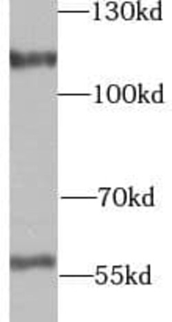 UTP14A Antibody - BSA Free, Novus Biologicals 100 &mu;g | Buy Online | Novus Biologicals | Fisher Scientific