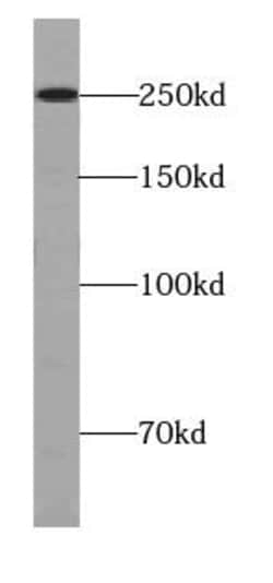URB1 Antibody - BSA Free, Novus Biologicals 100 &mu;g | Buy Online | Novus Biologicals | Fisher Scientific