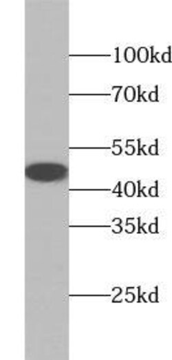 UBE2Q2 Antibody - BSA Free, Novus Biologicals 100 &mu;g | Buy Online | Novus Biologicals | Fisher Scientific