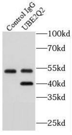 UBE2Q2 Antibody - BSA Free, Novus Biologicals 100 &mu;g | Buy Online | Novus Biologicals | Fisher Scientific