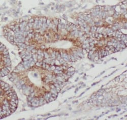 PTPN23 Antibody - BSA Free, Novus Biologicals 100 &mu;g | Buy Online | Novus Biologicals | Fisher Scientific