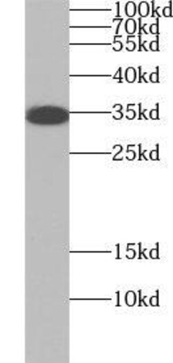 UBAC2 Antibody - BSA Free, Novus Biologicals 100 &mu;g | Buy Online | Novus Biologicals | Fisher Scientific