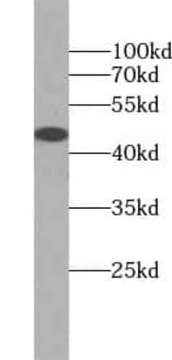 Tuftelin 1 Antibody - BSA Free, Novus Biologicals 100 &mu;g | Buy Online | Novus Biologicals | Fisher Scientific
