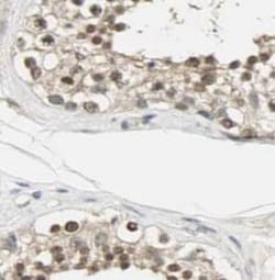 TSNAXIP1 Antibody - BSA Free, Novus Biologicals 100 &mu;g | Buy Online | Novus Biologicals | Fisher Scientific