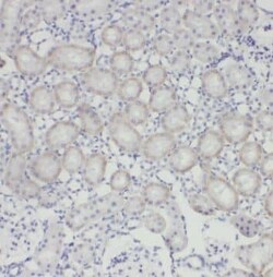 TRUB1 Antibody - BSA Free, Novus Biologicals 100 &mu;g | Buy Online | Novus Biologicals | Fisher Scientific