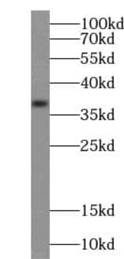 TRUB1 Antibody - BSA Free, Novus Biologicals 100 &mu;g | Buy Online | Novus Biologicals | Fisher Scientific