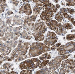 TRPT1 Antibody - BSA Free, Novus Biologicals 100 &mu;g | Buy Online | Novus Biologicals | Fisher Scientific