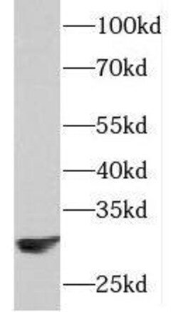 PAAF1 Antibody - BSA Free, Novus Biologicals 100 &mu;g | Buy Online | Novus Biologicals | Fisher Scientific
