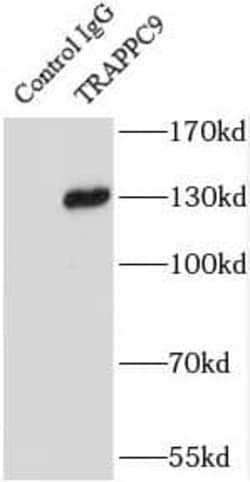 TRAPPC9 Antibody - BSA Free, Novus Biologicals 100 &mu;g | Buy Online | Novus Biologicals | Fisher Scientific