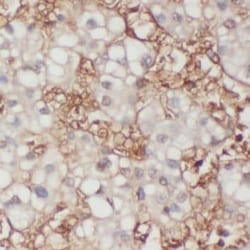 ALS2CR3 Antibody - BSA Free, Novus Biologicals 100 &mu;g | Buy Online | Novus Biologicals | Fisher Scientific