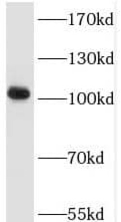 ALS2CR3 Antibody - BSA Free, Novus Biologicals 100 &mu;g | Buy Online | Novus Biologicals | Fisher Scientific