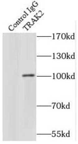 ALS2CR3 Antibody - BSA Free, Novus Biologicals 100 &mu;g | Buy Online | Novus Biologicals | Fisher Scientific