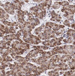 p53 DINP1 Antibody - BSA Free, Novus Biologicals 100 &mu;g | Buy Online | Novus Biologicals | Fisher Scientific