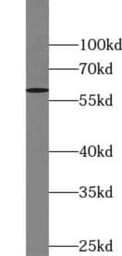 TOR1AIP2 Antibody - BSA Free, Novus Biologicals 100 &mu;g | Buy Online | Novus Biologicals | Fisher Scientific