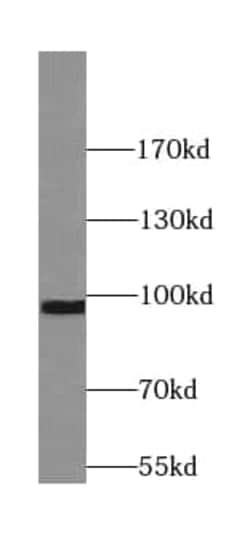 SYT11 Antibody - BSA Free, Novus Biologicals 100 &mu;g | Buy Online | Novus Biologicals | Fisher Scientific