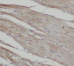 Surf1 Antibody - BSA Free, Novus Biologicals 100 &mu;g | Buy Online | Novus Biologicals | Fisher Scientific
