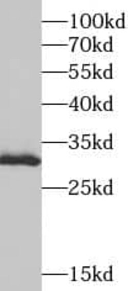 Surf1 Antibody - BSA Free, Novus Biologicals 100 &mu;g | Buy Online | Novus Biologicals | Fisher Scientific