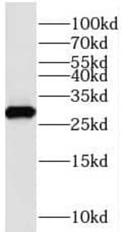 Amisyn Antibody - BSA Free, Novus Biologicals 100 &mu;g | Buy Online | Novus Biologicals | Fisher Scientific