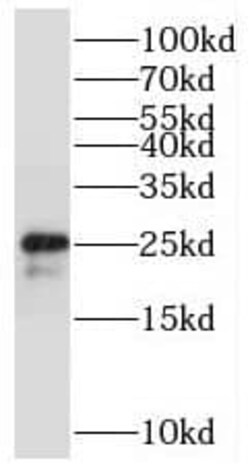 STMN4 Antibody - BSA Free, Novus Biologicals 100 &mu;g | Buy Online | Novus Biologicals | Fisher Scientific