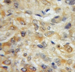 STMN4 Antibody - BSA Free, Novus Biologicals 100 &mu;g | Buy Online | Novus Biologicals | Fisher Scientific