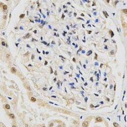 SNRPE Antibody - BSA Free, Novus Biologicals 100 &mu;g | Buy Online | Novus Biologicals | Fisher Scientific