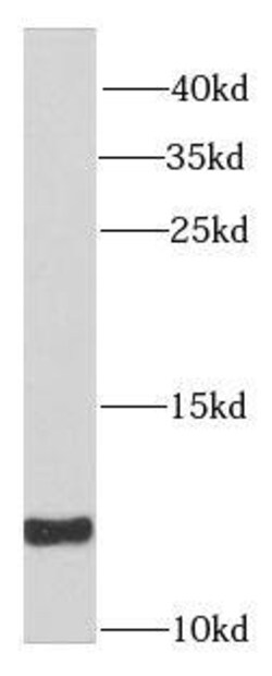 SNRPE Antibody - BSA Free, Novus Biologicals 100 &mu;g | Buy Online | Novus Biologicals | Fisher Scientific