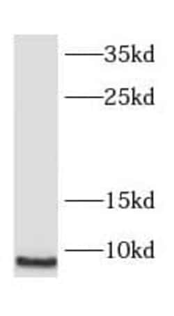 SMPX Antibody - BSA Free, Novus Biologicals 100 &mu;g | Buy Online | Novus Biologicals | Fisher Scientific