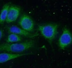 SLN Antibody - BSA Free, Novus Biologicals 100 &mu;g | Buy Online | Novus Biologicals | Fisher Scientific