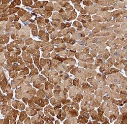 SLN Antibody - BSA Free, Novus Biologicals 100 &mu;g | Buy Online | Novus Biologicals | Fisher Scientific