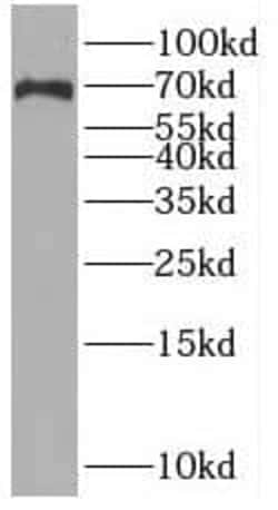SLC6A8 Antibody - BSA Free, Novus Biologicals 100 &mu;g | Buy Online | Novus Biologicals | Fisher Scientific