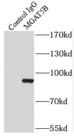 MGAT5B Antibody - BSA Free, Novus Biologicals 100 &mu;g | Buy Online | Novus Biologicals | Fisher Scientific